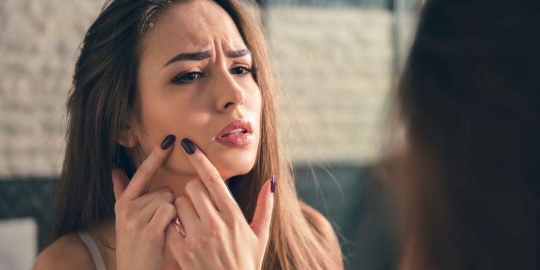acne treatment dermatology alamo heights san antonio texas