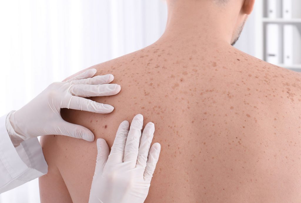 surgical dermatology alamo heights san antonio texas