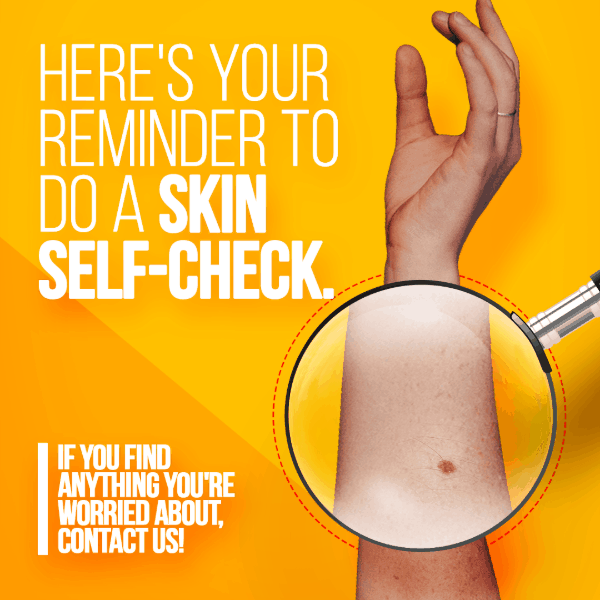 Self skin check, mole on arm, skin cancer prevention, dermatology